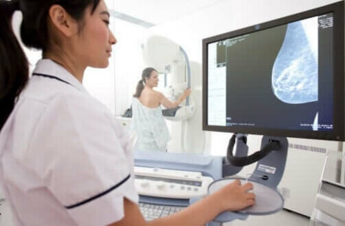 Mammographie Ultraschall