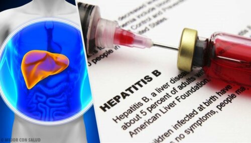 Leberkrankheiten: Hepatitis