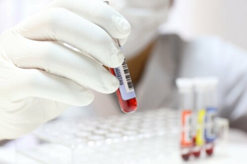 Monozyten im Blut untersuchen