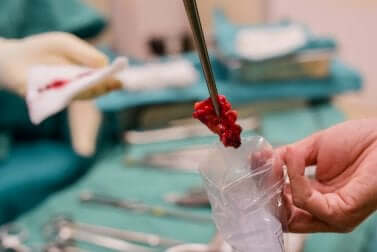 Welche Vorteile hat die Flüssigbiopsie?