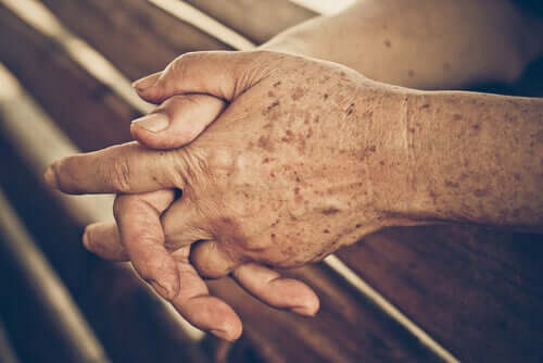 Pflege der Haut im Rentenalter