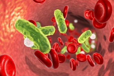 Urosepsis: Ursachen und Behandlung