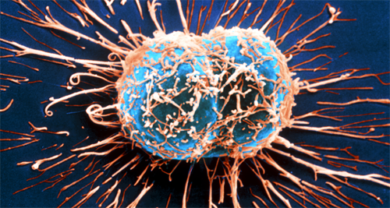 Wie wirkt das Immunsystem gegen Krebs?