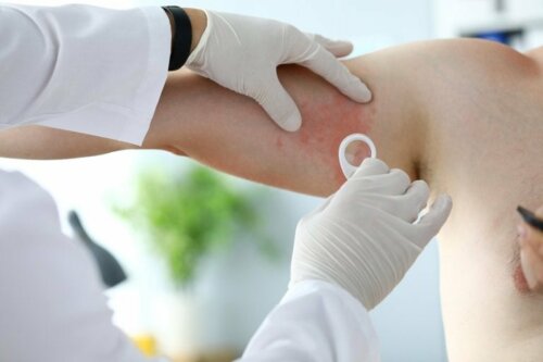 Hautarzt untersucht einen Patienten