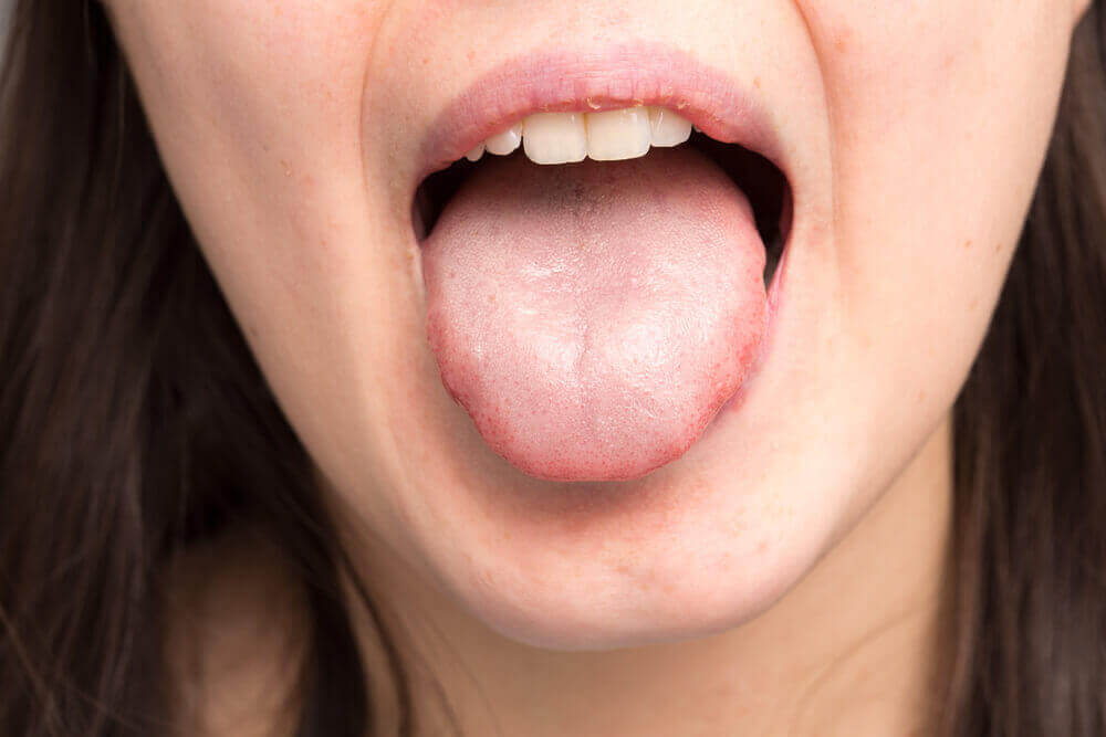Die Unterkieferspeicheldrüsen Besser Gesund Leben