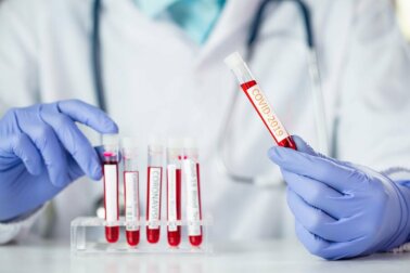 Coronavirus: Welche Rolle spielt die Blutgruppe?