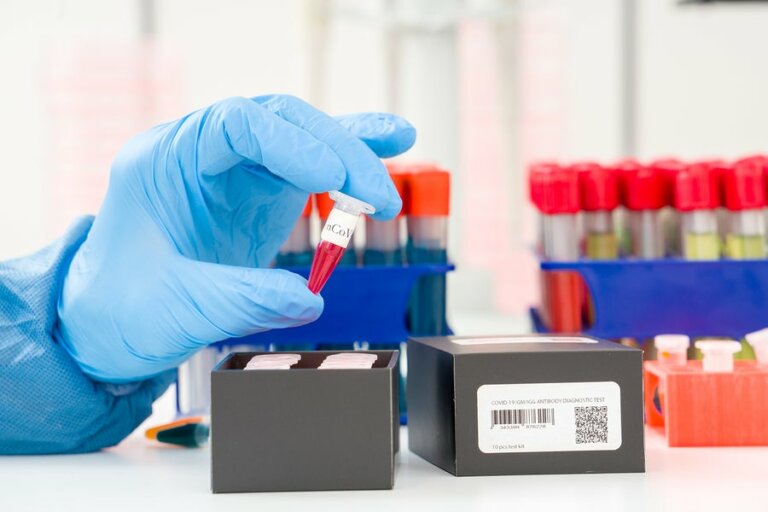 Wie funktioniert der Corona-PCR-Test?