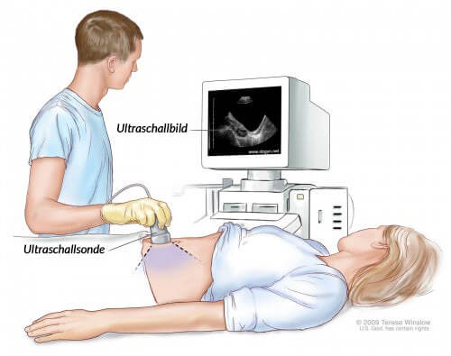 Untersuchung per Ultraschall
