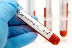 Coronavirus nach der Genesung?
