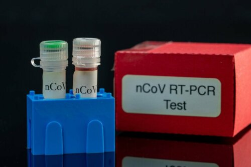 PCR-Test