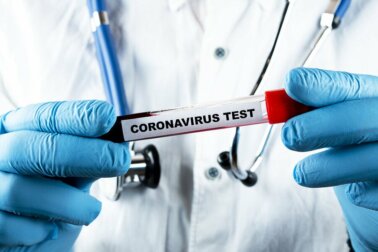 Corona-Pandemie: Welche Tests gibt es?