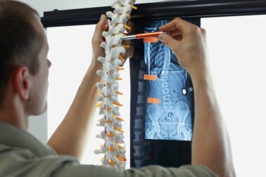 Knochenmetastasen: Symptome und Behandlungsmöglichkeiten