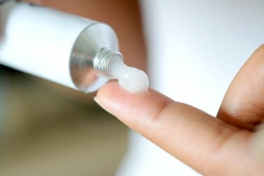 Kortisonhaltige Salben zur äußerlichen Anwendung
