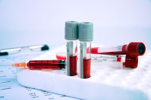 pharmakologische Behandlung von Anämie