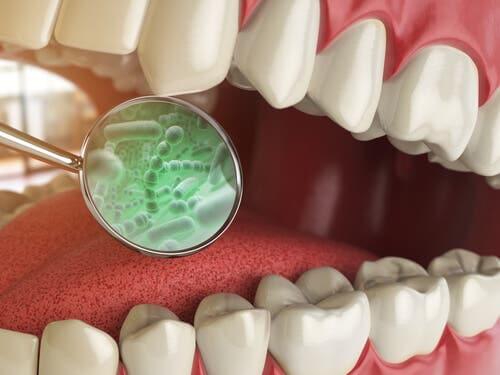 Wissenswertes über die Bakterien im Mund