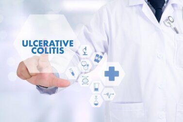 Colitis ulcerosa: 5 Tipps, um akute Schübe zu verhindern