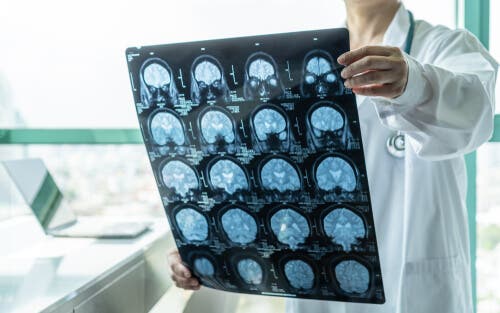 Enzephalitis durch Röntgen diagnostizieren