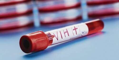 HIV-Patient