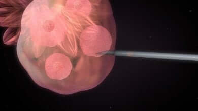 In-vitro-Fertilisation