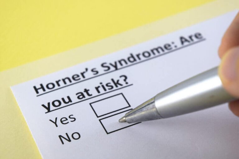 Horner-Syndrom: Was ist das?