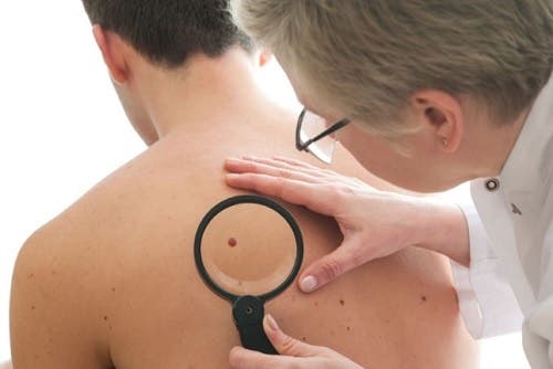 Regelmäßige Kontrolluntersuchungen zum Schutz deiner Haut