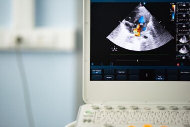 Bikuspide Aortenklappe: Diagnose und Behandlung