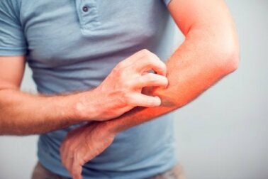 Was tun gegen Juckreiz? 5 Hausmittel