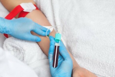 Blutplasmatransfusion: Ablauf, Arten und Risiken
