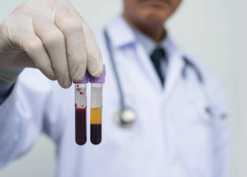 Wann ist eine Blutplasmatransfusion nötig?
