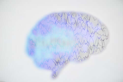 epileptische Krise