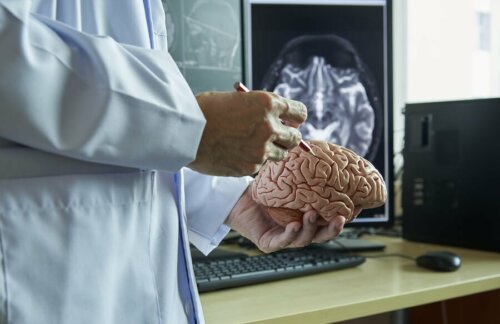 Arzt erklärt durch Multiple Sklerose betroffene Gehirnbereiche