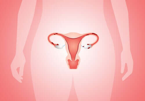 Cáncer de útero - órganos reproductores femeninos