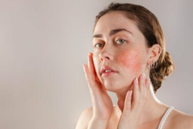 Hautreaktivität: Ursachen und Behandlungsmöglichkeiten