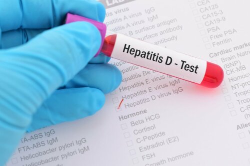 Hepatitis Test