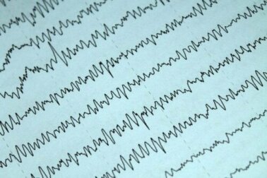 Wichtige Aspekte über Epilepsie und Stillzeit