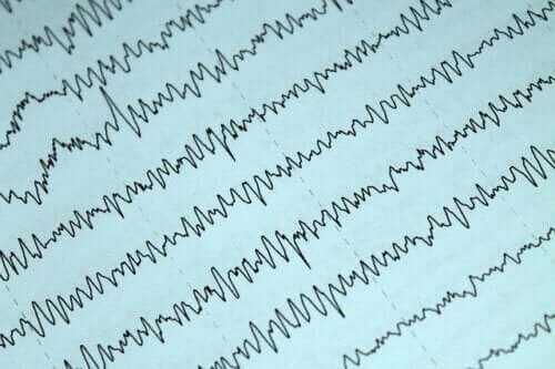 Wichtige Aspekte über Epilepsie und Stillzeit