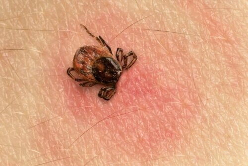 Lyme-Borreliose durch Zecken