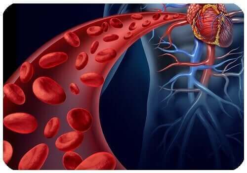 Bauchaortenaneurysma - Arterie