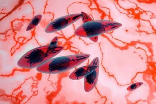 Okuläre Toxoplasmose - Parasiten unter dem Mikroskop