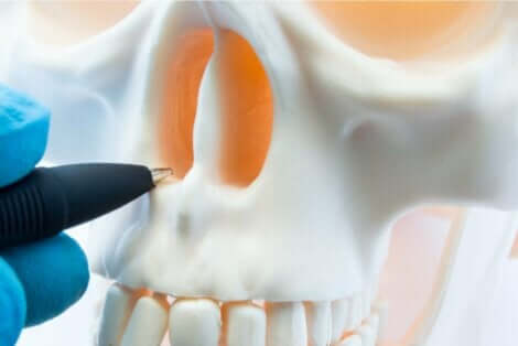 Die Septumplastik wird durchgeführt, um eine verkrümmte Nasenscheidewand zu begradigen