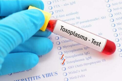 Okuläre Toxoplasmose - Test