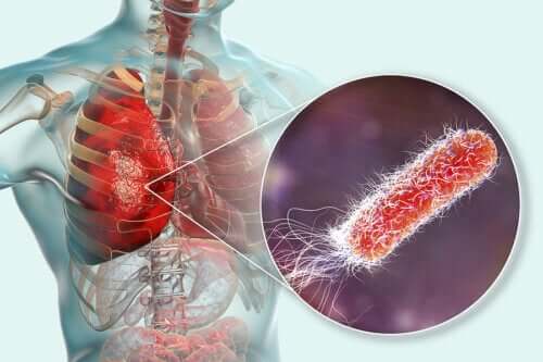 Bakterien in den Lungen? Was du darüber wissen solltest
