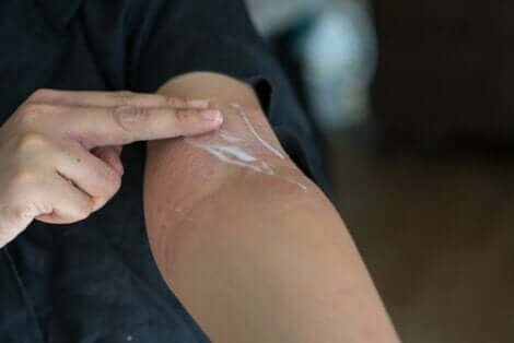Die empfohlene Behandlung eines Hautausschlages hängt hauptsächlich auch von dem verursachenden Erreger ab