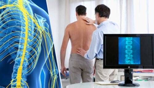 Magnettherapie bei MS