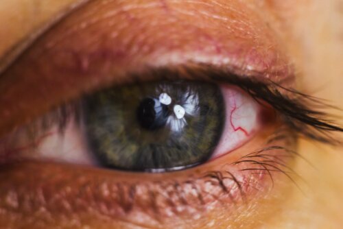 tränende Augen