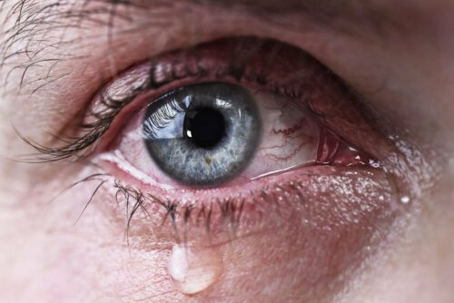 tränende Augen