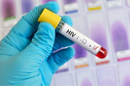 Übertragung von HIV - Test