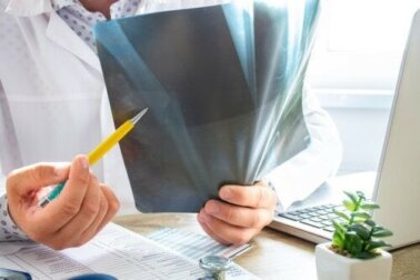 Knochenödem: Alles, was du darüber wissen solltest
