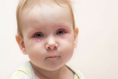Bindehautentzündung bei Kindern: Was soll ich tun?