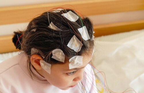 Elektroenzephalogramm Mädchen